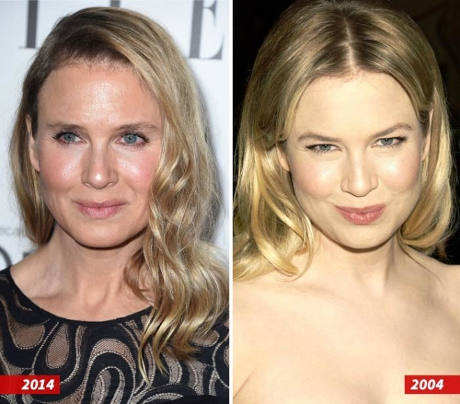 Renee Zellweger Before and After